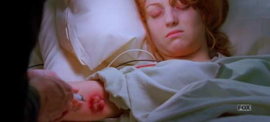 Dr. Gregory House extracting fluid from plague buboles.